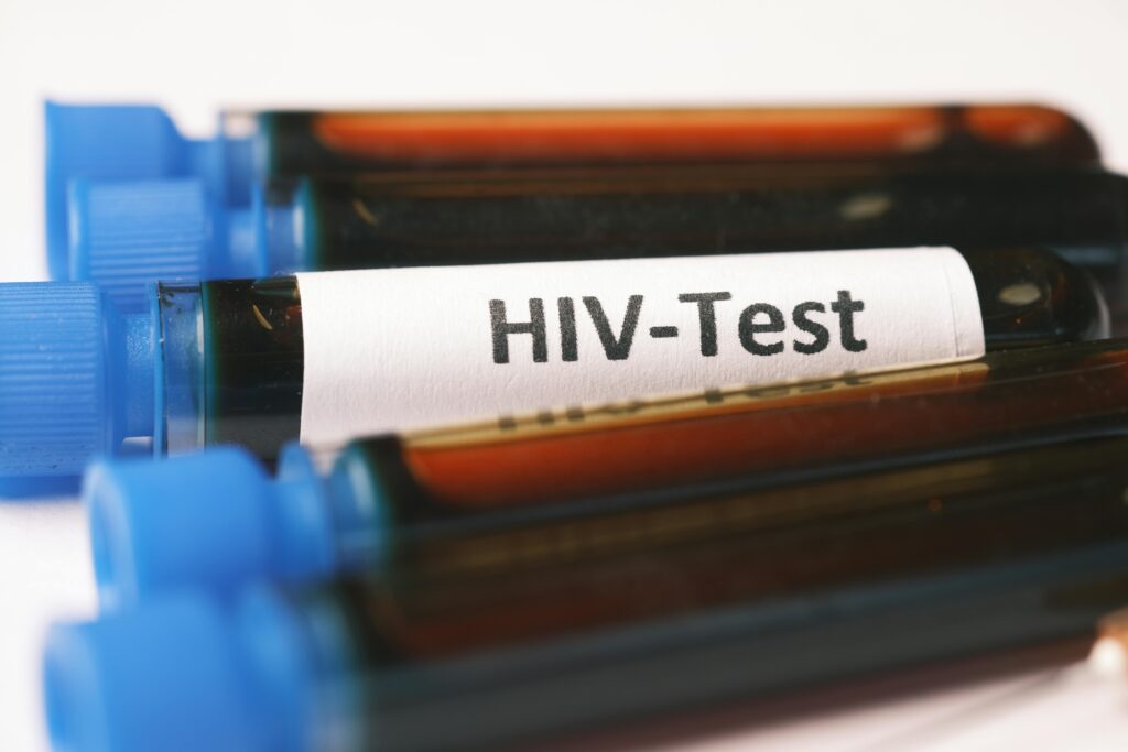 HIV in Healthcare