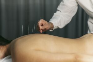 Meditation and Acupuncture Are on the Rise